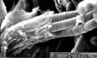 Living cyanobacteria Microcoleus chthonoplastes emerge from wrinkled muscilaginous sheath...